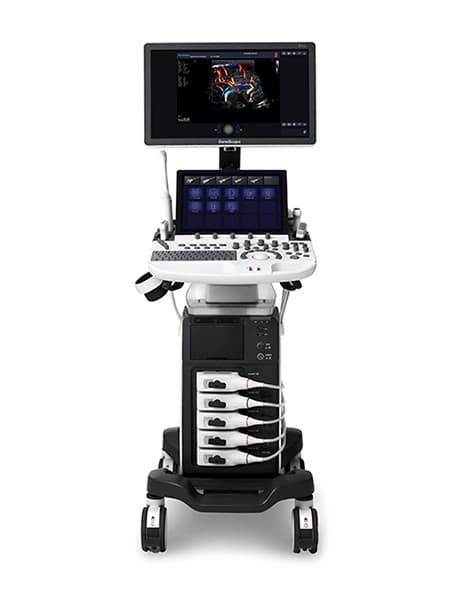 고사양 초음파 진단기